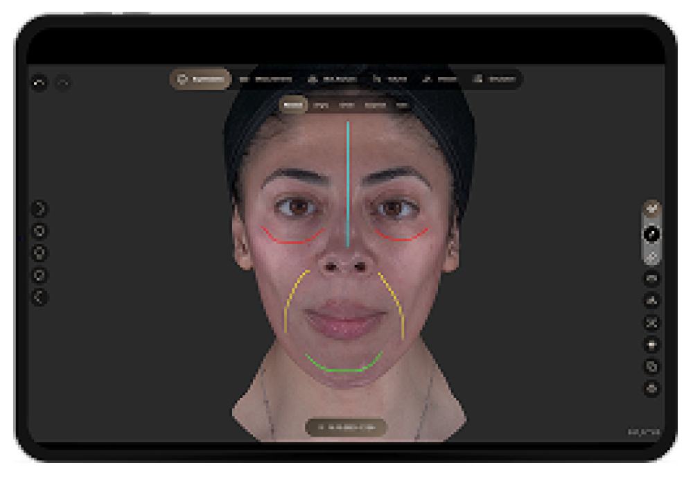 Screenshot of a woman’s face with facial-analysis overlays (cyan midline, red under-eye curves, yellow cheek-to-mouth arches, green chin line) on a dark UI background