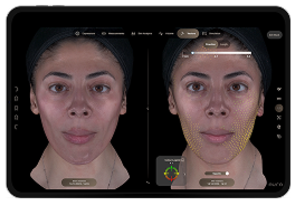 Side-by-side facial analysis: two views of a woman's face in a skincare app, left with smooth texture, right showing a highlighted dermal map.