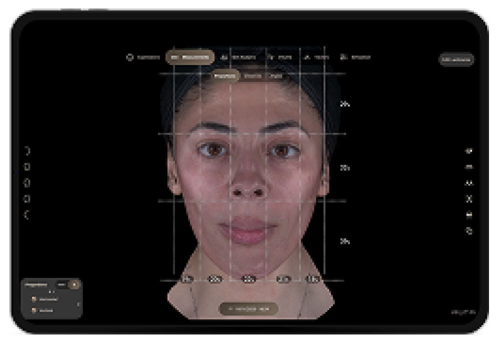 Portrait of a woman within a facial-alignment tool showing gridlines and measurement marks on her face.