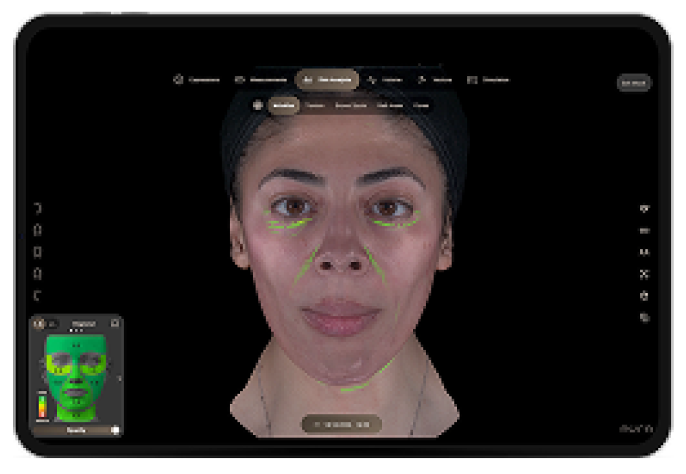 Face with green contour lines showing wrinkle and contour mapping in a skin analysis app on a dark screen with a small inset panel in the corner